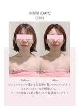 トゥインクル 麻布(twinkle)/港区/麻布十番/南麻布/小顔矯正