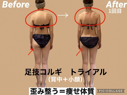 レアフィート(Rheafeet)の写真