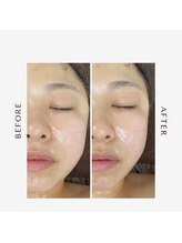 ラ ルアナ(La Luana)/ラジオ波×EMS×スカルプケア