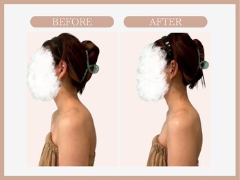 スリムライン 仙台店(The Slim Line)/before→after