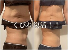 サルサナ(Salu Sana)