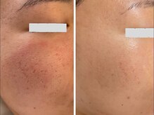 ポ ワール(Poir)/