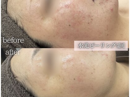 ミレット(Miretto)の写真