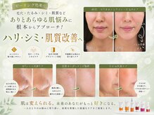 エーサロン(A-Salon)の雰囲気（【実績】シワ・シミ・たるみ・ニキビ・多数の改善例ございます）