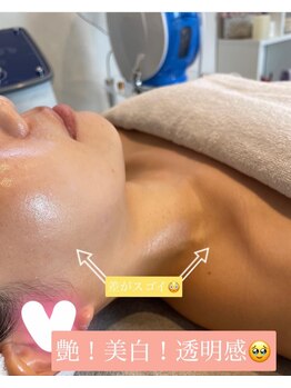 ジュエッテ(jouete)/艶！美白！透明感！