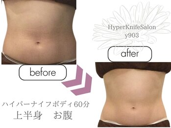ワイキューマルサン(y903)/ハイパーナイフボディ60分上半身