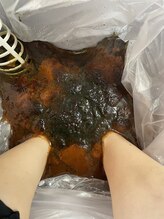 ティンガーラ(TINGARA)/足湯デトックスゴットクリーナー