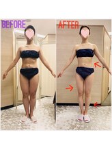 エステティックサロン アール 大阪梅田(esthetic salon R)/30代女性　前