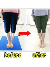 ストレッチヒーロー 福山春日店/膝に痛みがある方に◎