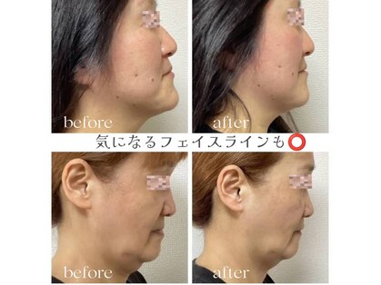 小顔整体 優の写真