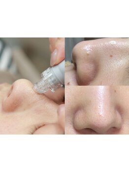 お肌をきれいにしたい