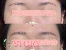 ストーリー(STORY)/眉毛と艶肌ワックス専門店