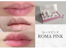 芯美 恵比寿店(shinbi)の雰囲気（色素ケアに特化したローマピンク商材！自然なピンク色に♪）