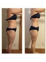 エステサロンブランシュ(Esthe salon Blanche)/痩身エステ