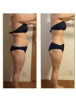 エステサロンブランシュ(Esthe salon Blanche)/痩身エステ