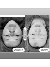 リシェラード/大人女子のためのシミケア
