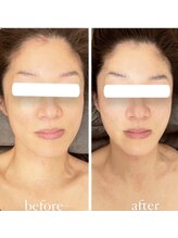 ジーニー(Genie)/歪み矯正はサービス