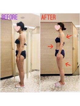 エステティックサロン アール 大阪梅田(esthetic salon R)/30代女性　横