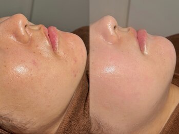 ルーナジェーナ(Luna llena)/池袋 エステ ルーナジェーナ