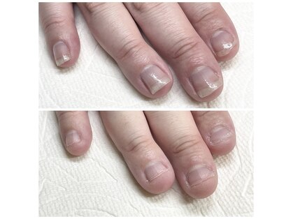 ティアラ(Tiara)の写真