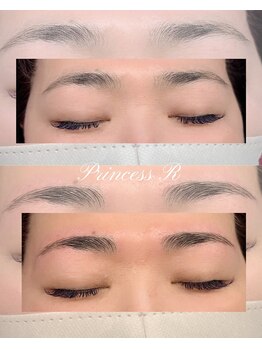 プリンセスアール(Princess R)/美眉トータルケア