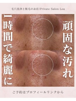 レア(Lea)/頑固な汚れもしっかり綺麗に