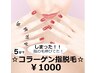 【脱毛】しまった！指の毛伸びてた！！　コラーゲン指脱毛￥1000+税