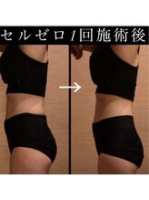 マイン イオンモール浜松市野店/大人気！セルライトゼロ！