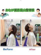 おなが浦添当山整体院/頚痛み軽減