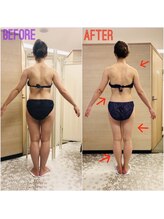 エステティックサロン アール 大阪梅田(esthetic salon R)/30代女性　後