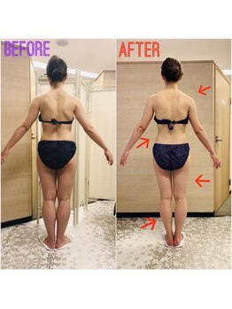 エステティックサロン アール 大阪梅田(esthetic salon R)/30代女性　後