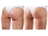 脱セル美ボディ☆脂肪燃焼コース（定価13,800相当）8,800→7,040