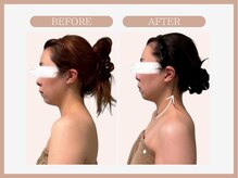 スリムライン 仙台店(The Slim Line)/before→after