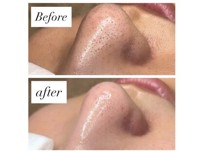 ライム(LIME)の写真