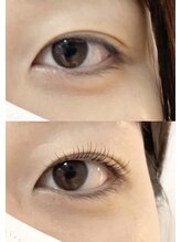 abp /ラッシュリフト