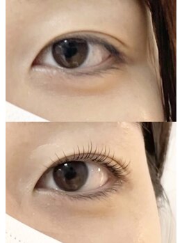 abp /ラッシュリフト