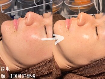 ルーナジェーナ(Luna llena)/