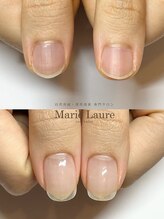 マリーロール 梅田店(Marie Laure)/自爪育成/深爪矯正/ネイルケア