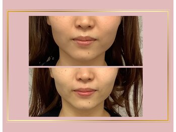 小顔美肌コルギ専門店 センティード 吉祥寺(Sentido)/『小顔美肌コルギ』10回目