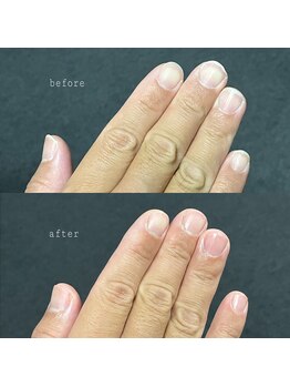 眉毛男子 新宿店/ネイルケア 　before / after