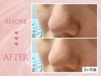 クリアラボ 池袋(Clear Lab)/韓国肌管理&毛穴洗浄専門店