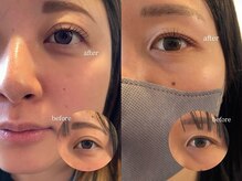 サマー(SUMMER)の雰囲気（1人1人に合わせたカールデザインをご提案します♪）