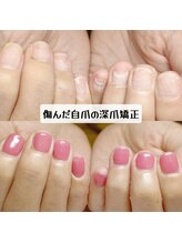マニエネイル(mani e nail)/剥離爪を保護しながら、自爪育成
