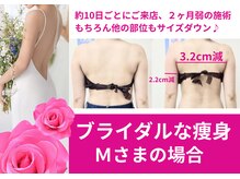 スマイルデイズ(Smiledays)の雰囲気（挙式まで時間がなくても大丈夫！結果は出せます♪）