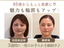 エステサロン ピースフルの雰囲気(お顔の印象がどんどん変わります♪ホームページに実例多数掲載!)