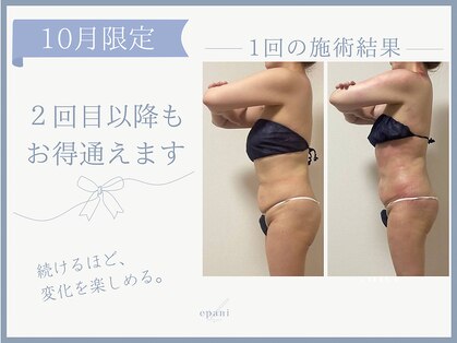 エパニ(epani)の写真