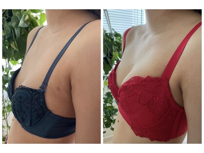 ビービリア(B.villea)の写真