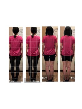 パワーパステル/Ｏ脚改善…快適な夏へ