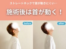 整体院カイト/【首・肩こり】お客様の変化