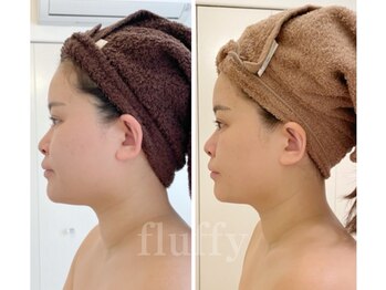 フラフィ 宇都宮本店(fluffy)/横顔もスッキリ全然違う！